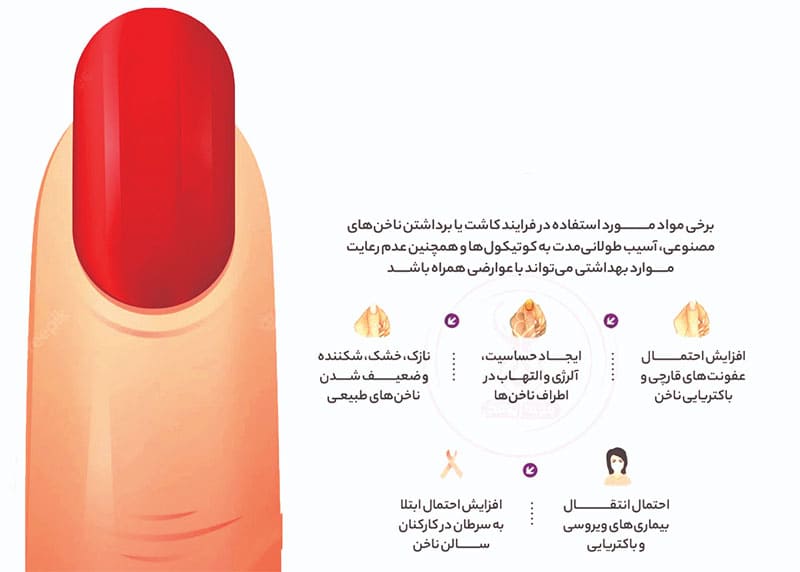 عوارض کاشت ناخن کدام اند؟
