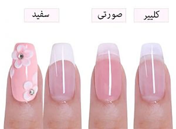 کاشت کلیر